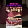 Thumbnail of new posts 160