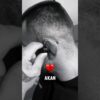 Thumbnail of related posts 159